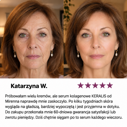 Serum Kolagenowe 58% do Skóry Suchej