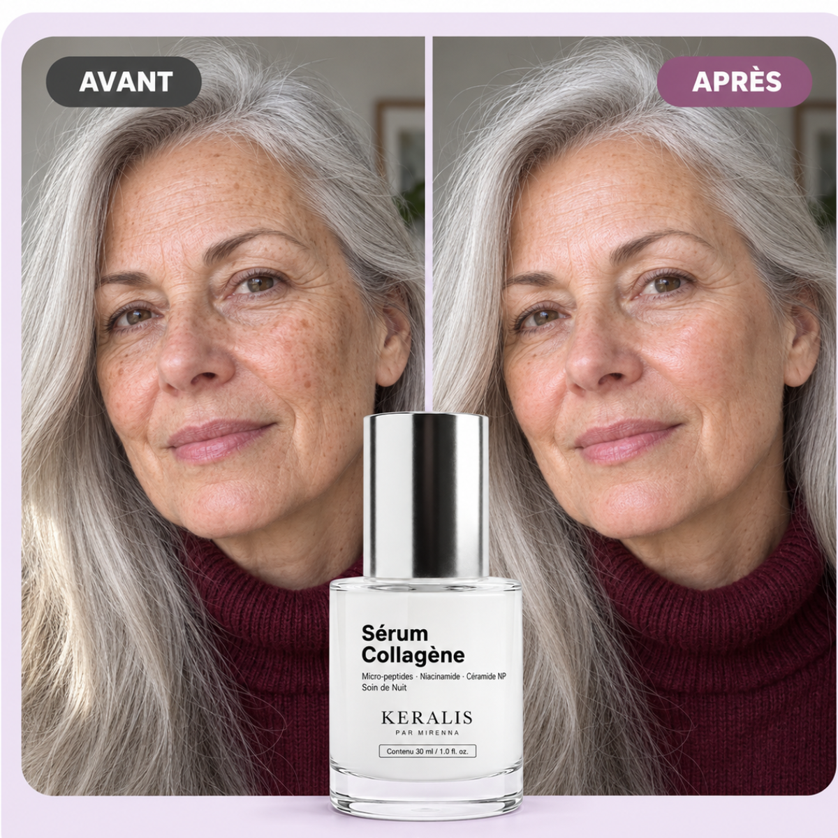 Avant après sérum collagène KERALIS avec le flacon