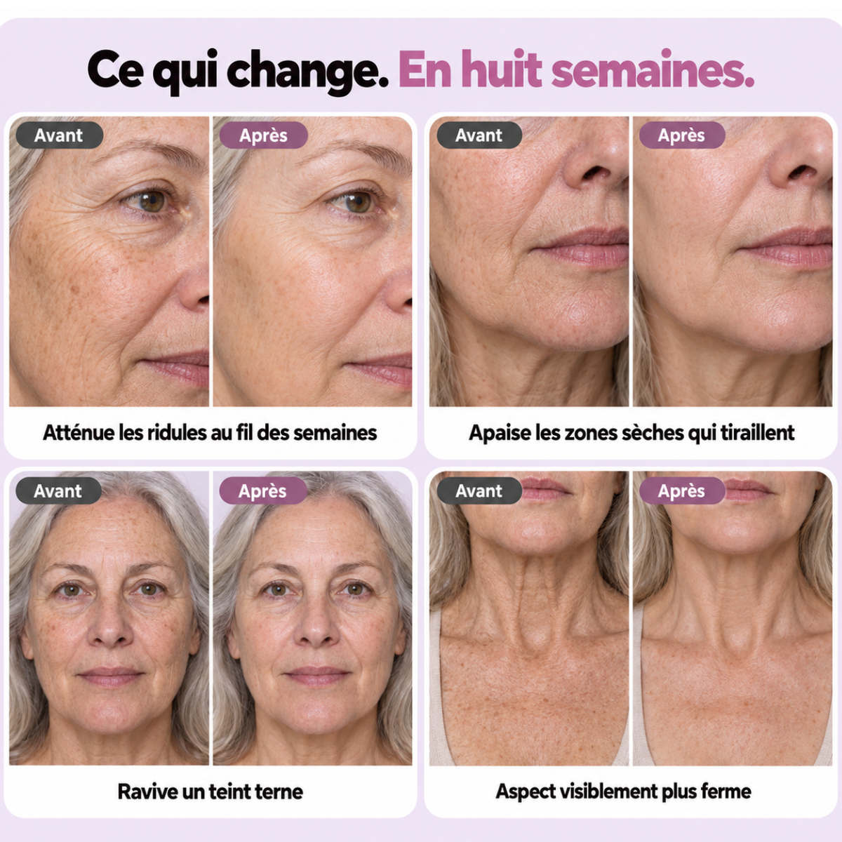 Avant après KERALIS en huit semaines : ridules, zones sèches, teint, fermeté