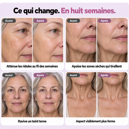 Avant après KERALIS en huit semaines : ridules, zones sèches, teint, fermeté